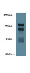 Western Blot; Sample: Rat Serum; Primary Ab: 1µg/ml Rabbit Anti-Rat THBS1 Antibody Second Ab: 0.2µg/mL HRP-Linked Caprine Anti-Rabbit IgG Polyclonal Antibody