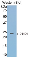 Western Blot; Sample: Recombinant protein.