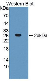 Western Blot; Sample: Recombinant protein.