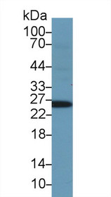 Western Blot; Sample: Human Serum; Primary Ab: 2µg/ml Rabbit Anti-Human GSTa1 Antibody Second Ab: 0.2µg/mL HRP-Linked Caprine Anti-Rabbit IgG Polyclonal Antibody