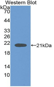 Western Blot; Sample: Recombinant protein.