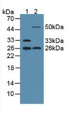 Western Blot; Sample: Lane1: Rat Serum; Lane2: Rat Uterus Tissue.