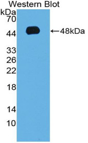 Western Blot; Sample: Recombinant protein.