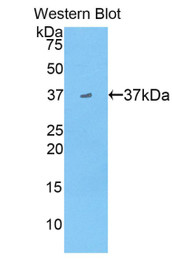 Western Blot; Sample: Recombinant protein.