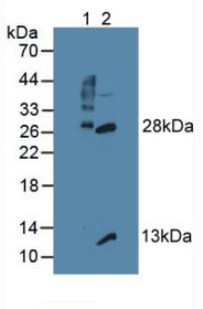 Western Blot; Sample: Lane1: Mouse Thymus Tissue; Lane2: Mouse Lymph Node Tissue.