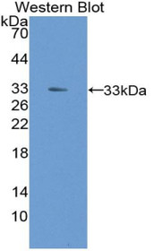 Western Blot; Sample: Recombinant protein.