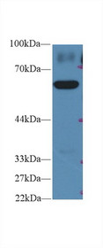 Western Blot; Sample: Human HepG2 cell lysate; Primary Ab: 2µg/ml Rabbit Anti-Rat PKM2 Antibody Second Ab: 0.2µg/mL HRP-Linked Caprine Anti-Rabbit IgG Polyclonal Antibody