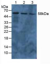 Western Blot; Sample: Lane1: Human A549 Cells; Lane2: Human HepG2 Cells; Lane3: Human Hela Cells.