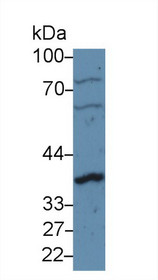 Western Blot; Sample: Human U87MG cell lysate; Primary Ab: 5µg/ml Rabbit Anti-Rat CCND1 Antibody Second Ab: 0.2µg/mL HRP-Linked Caprine Anti-Rabbit IgG Polyclonal Antibody