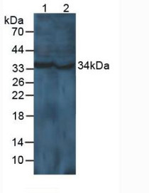 Western Blot; Sample: Lane1: Mouse Brain Tissue; Lane2: Rat Brain Tissue.