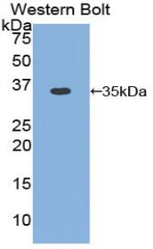Western Blot; Sample: Recombinant protein.
