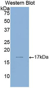 Western Blot; Sample: Recombinant protein.