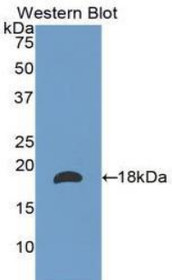 Western Blot; Sample: Recombinant protein.
