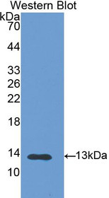 Western Blot; Sample: Recombinant protein.