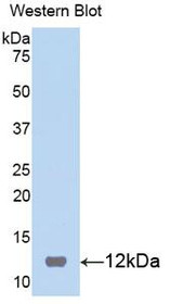 Western Blot; Sample: Recombinant protein.
