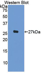 Western Blot; Sample: Recombinant protein.