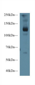 Western Blot; Sample: Porcine Skeletal muscle lysate; ;Primary Ab: 1µg/ml Rabbit Anti-Human LIFR Antibody;Second Ab: 0.2µg/mL HRP-Linked Caprine Anti-Rabbit IgG Polyclonal Antibody;