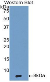 Western Blot; Sample: Recombinant protein.