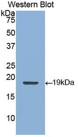 Western Blot; Sample: Recombinant protein.