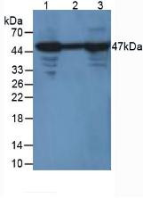 Western Blot; Sample. Lane1: Mouse Muscle Tissue; Lane2: Mouse Heart Tissue; Lane3: Mouse Brain Tissue.