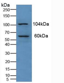 Western Blot; Sample: Human Liver Tissue.