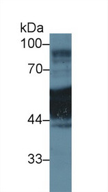 Western Blot; Sample: Human A431 cell lysate; Primary Ab: 1µg/ml Rabbit Anti-Rat KRT1 Antibody Second Ab: 0.2µg/mL HRP-Linked Caprine Anti-Rabbit IgG Polyclonal Antibody