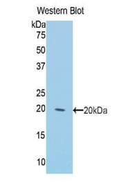 Western Blot; Sample: Recombinant protein.