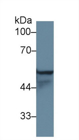 Western Blot; Sample: Human A431 cell lysate; Primary Ab: 1µg/ml Rabbit Anti-Rat KRT4 Antibody Second Ab: 0.2µg/mL HRP-Linked Caprine Anti-Rabbit IgG Polyclonal Antibody
