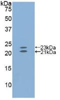 Western Blot; Sample: Recombinant EDN1, Mouse.