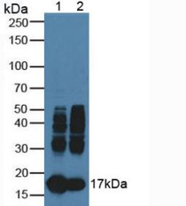 Western Blot; Sample: Lane1: Bovine Heart Tissue; Lane2: Bovine Skeletal Muscle Tissue.
