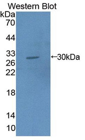 Western Blot; Sample: Recombinant protein.