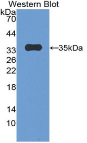 Western Blot; Sample: Recombinant protein.