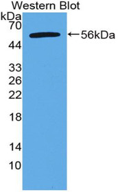 Western Blot; Sample: Recombinant protein.