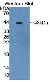 Western Blot; Sample: Recombinant protein.