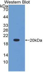 Western Blot; Sample: Recombinant protein.