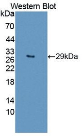 Western Blot; Sample: Recombinant protein.