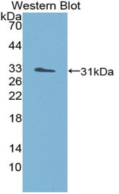 Western Blot; Sample: Recombinant protein.