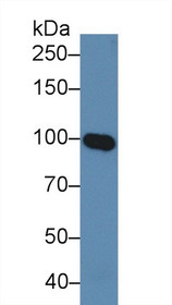 Western Blot; Sample: Human Serum; Primary Ab: 5µg/ml Rabbit Anti-Human MAG Antibody Second Ab: 0.2µg/mL HRP-Linked Caprine Anti-Rabbit IgG Polyclonal Antibody