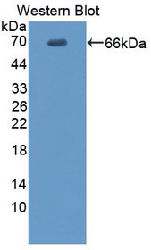 Western Blot; Sample: Recombinant protein.