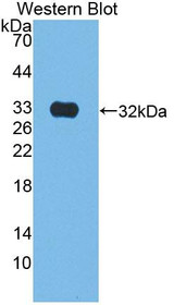 Western Blot; Sample: Recombinant protein.