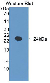 Western Blot; Sample: Recombinant protein.