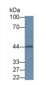 Inhibin Alpha (INHa) Polyclonal Antibody, CAU27980