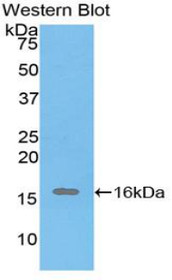 Western Blot; Sample: Recombinant protein.