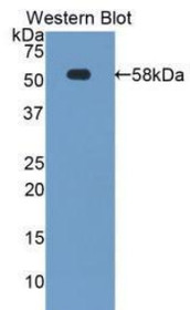 Western Blot; Sample: Recombinant protein.