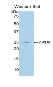 Western Blot; Sample: Recombinant protein.