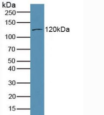 Western Blot; Sample: Mouse Brain Tissue.