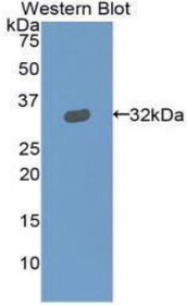Western Blot; Sample: Recombinant protein.