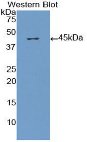 Western Blot; Sample: Recombinant protein.
