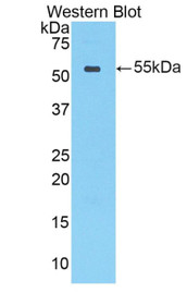 Western Blot; Sample: Recombinant protein.