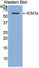 Western Blot; Sample: Recombinant protein.